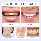 14x Bandes de Blanchiment Dentaire au Gel Violet - EXPRESS' 30min