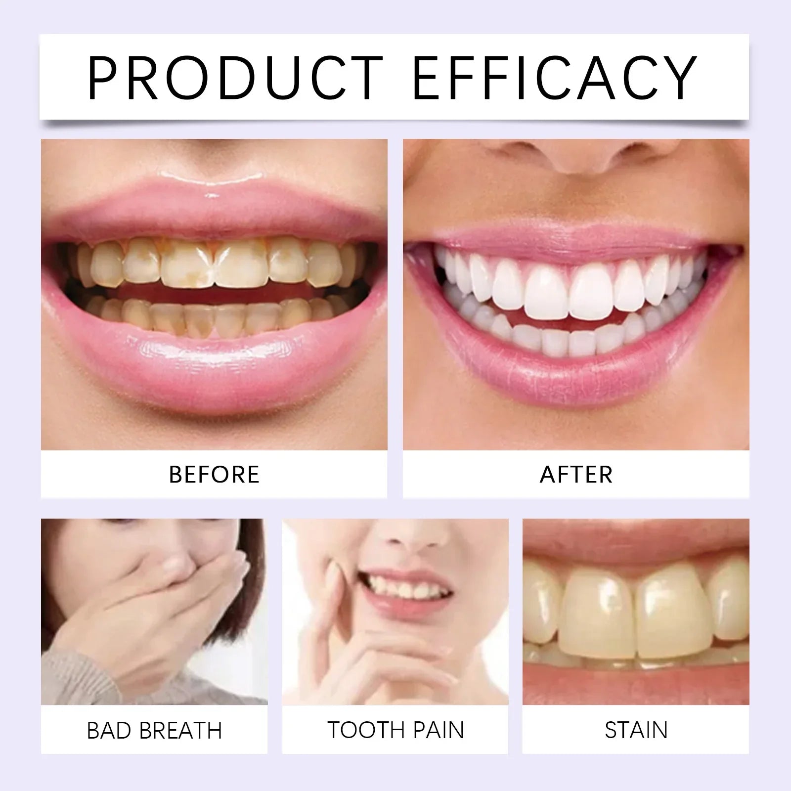 14x Bandes de Blanchiment Dentaire au Gel Violet - EXPRESS' 30min