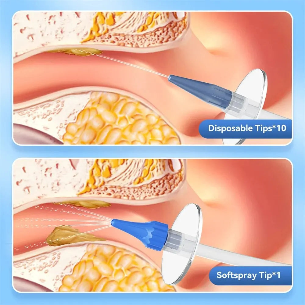 Kit Nettoyeur Irrigateur d'oreilles à eau