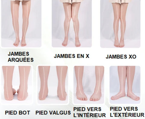 Semelles Orthopédiques Pour Pieds Plats